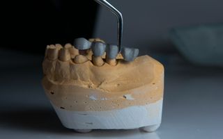 Do I Need a Root Canal?