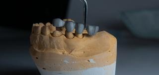 Endodontics (root canal)