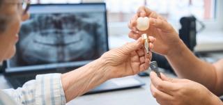 Dental Implants
