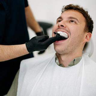 Bruxism (Teeth Grinding) Splints - impressions of the teeth