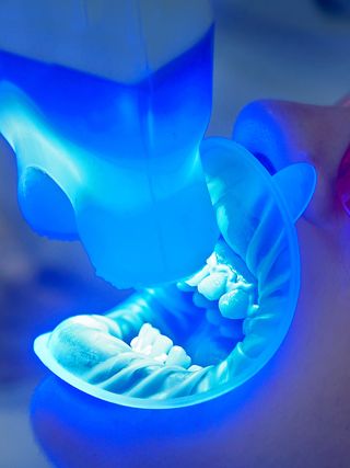 state of the art dental technology - 05