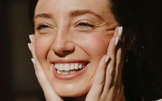 What is a Smile Makeover?