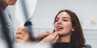 Veneers Moonee Ponds Dental Group