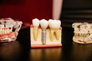 Placement of the Implant