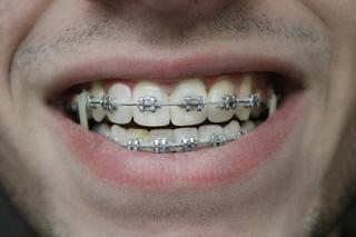 Dental emergency issues