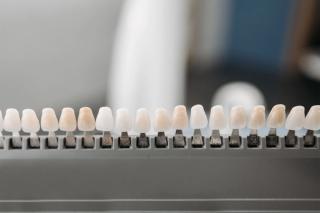 Why Choose DentalCare Carnegie? - Veneers