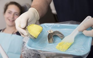 An image of a orthodontics mould.