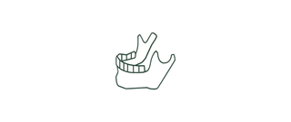 Do You Suffer with TMJ Pain?