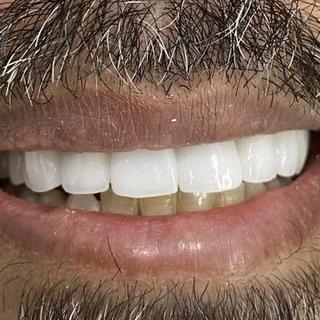 Cosmetic Dentistry - After