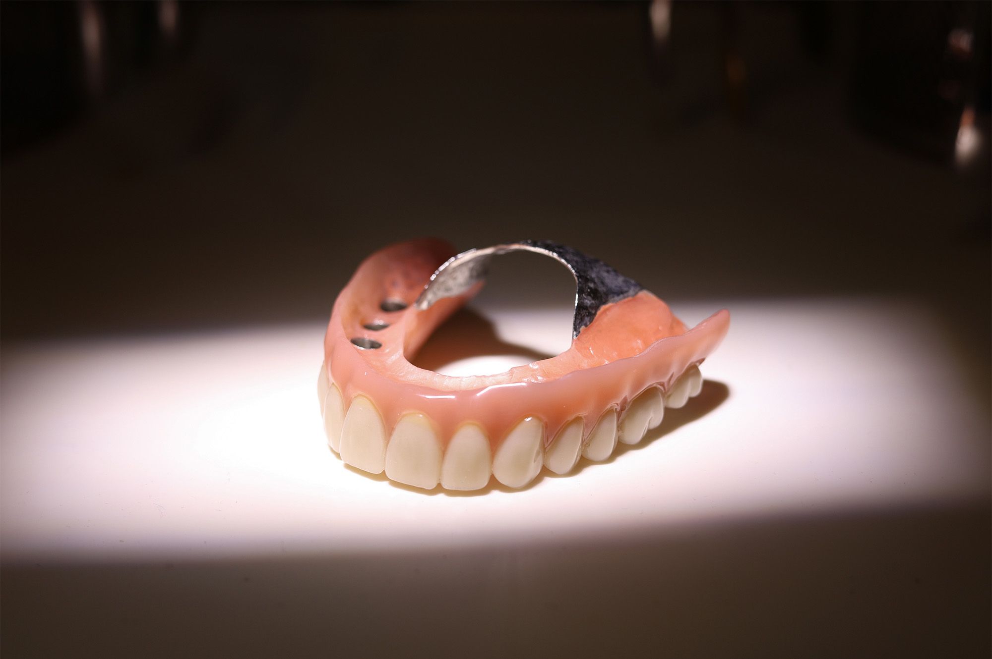 Implant Supported Dentures