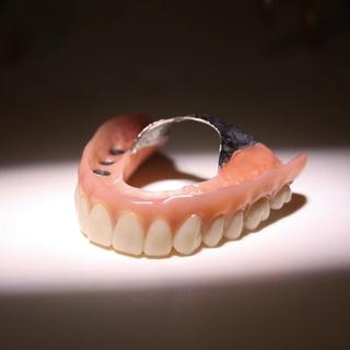 Implant Supported Dentures