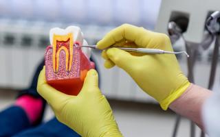 What is endodonics?