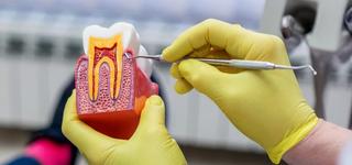 What Is a Root Canal Treatment?