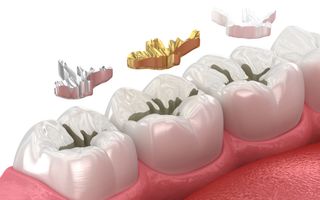 Examine Teeth Filling
