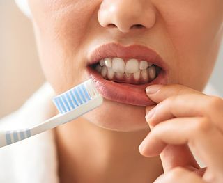 Poor oral hygiene & gingivitis