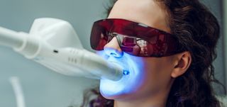 Teeth Whitening in Dentist WA