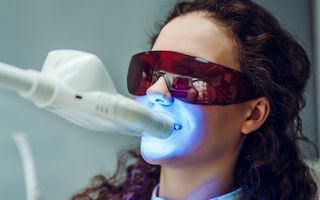 In-chair teeth whitening with Phillips Zoom! at Ranford Road Dental Centre.