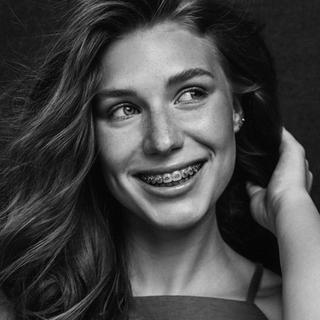 Traditional Braces 1