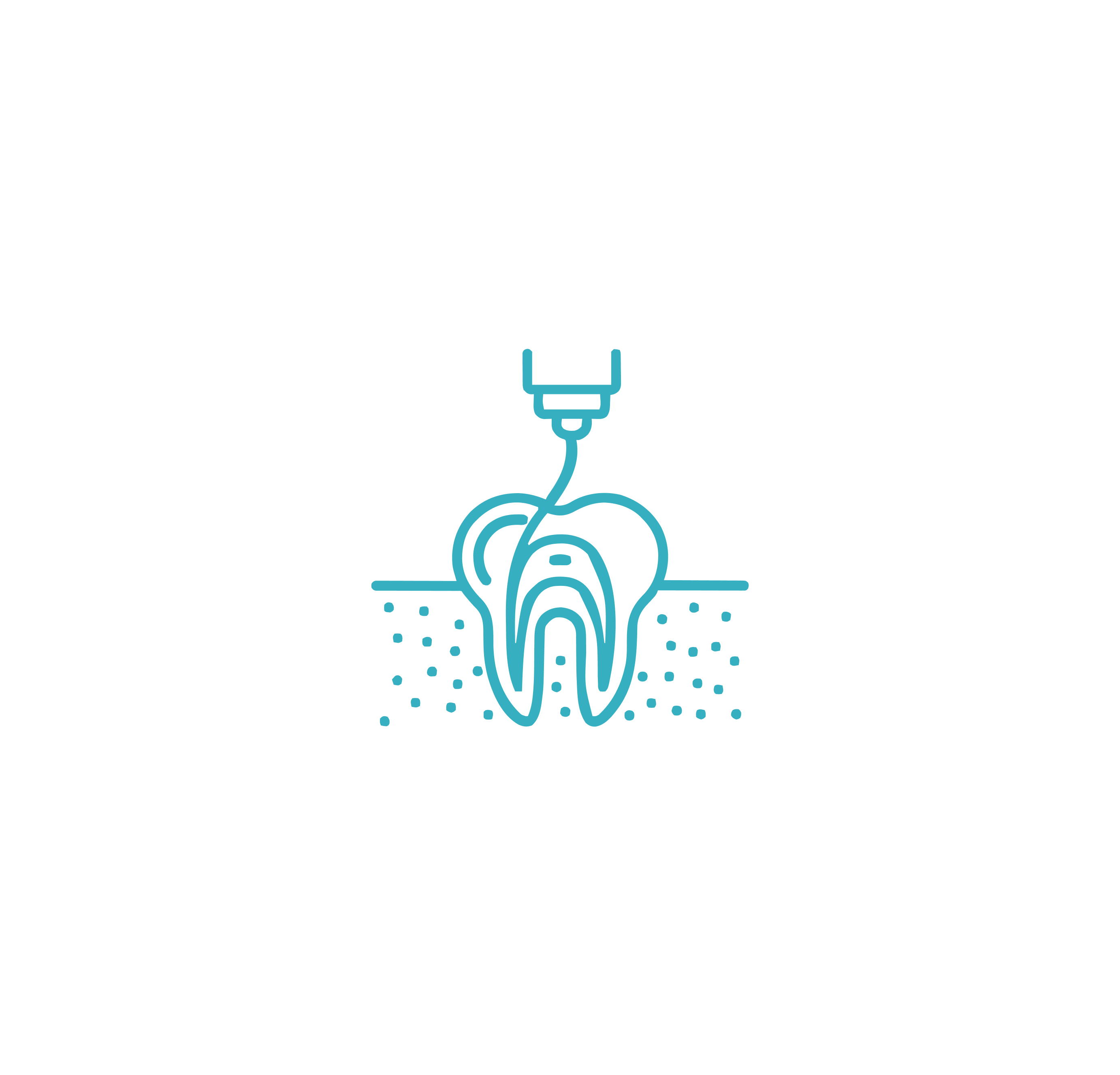 What is a Root Canal Treatment (RCT)