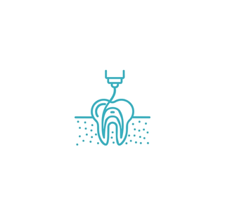 What is a Root Canal Treatment (RCT)