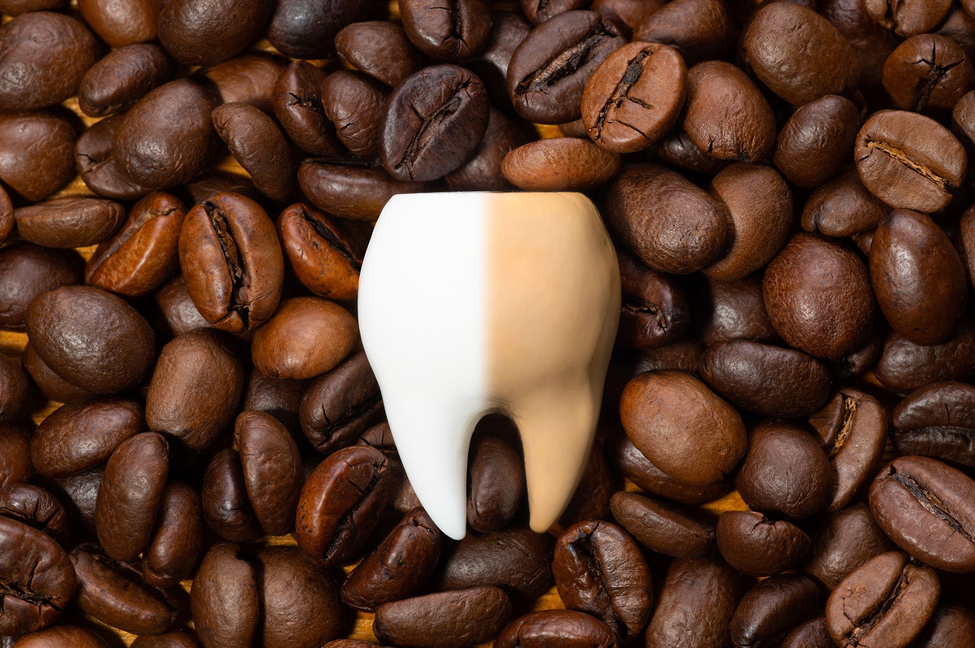 Teeth Whitening