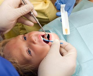 What to Expect During a Dental Sealant Treatment