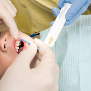 Fluoride treatments