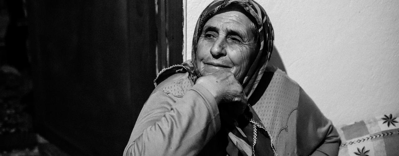 Tobacco's Impact on Skin Health and Aging - KEA HEALTH