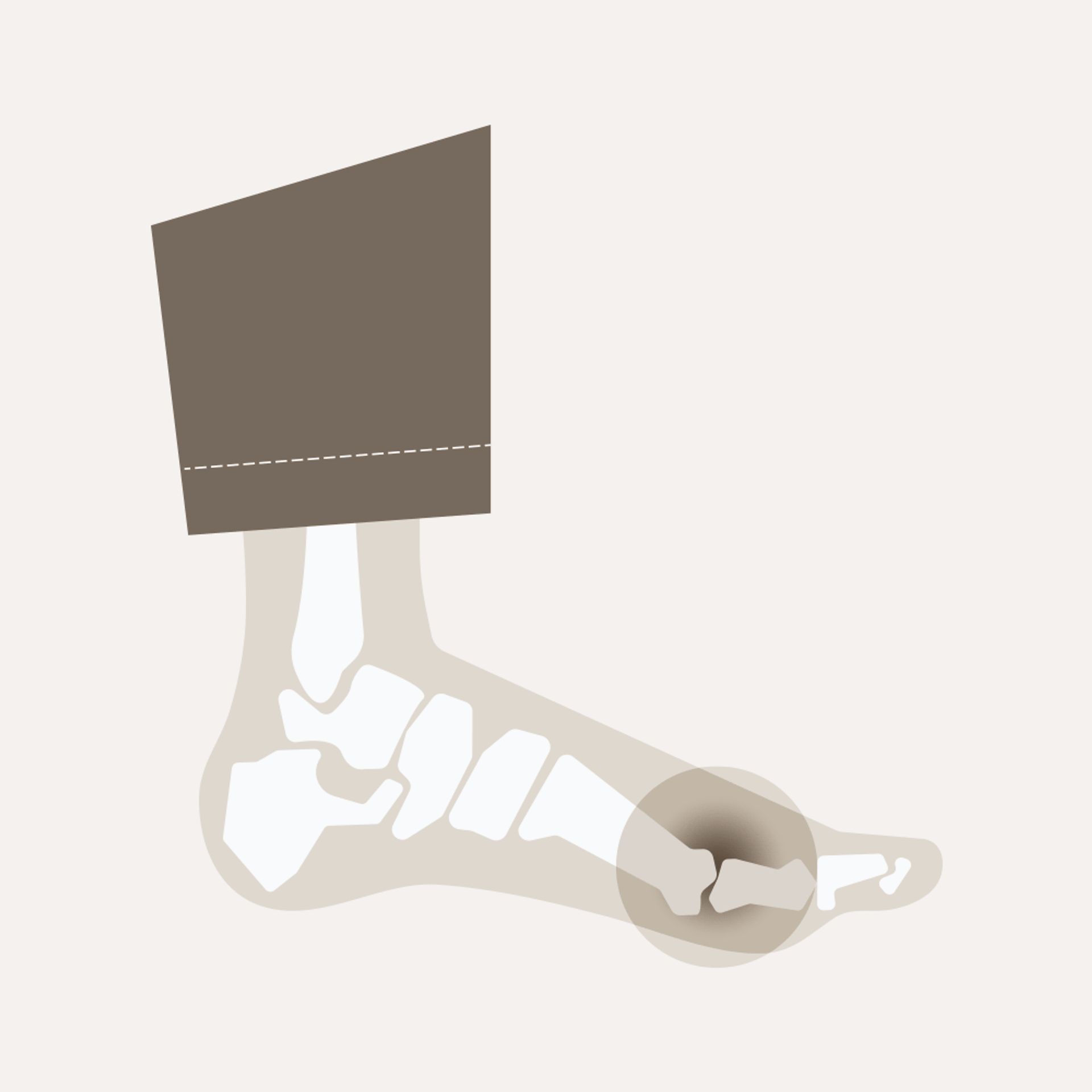 Shoes for foot pain