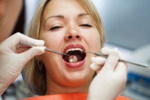 tooth extraction