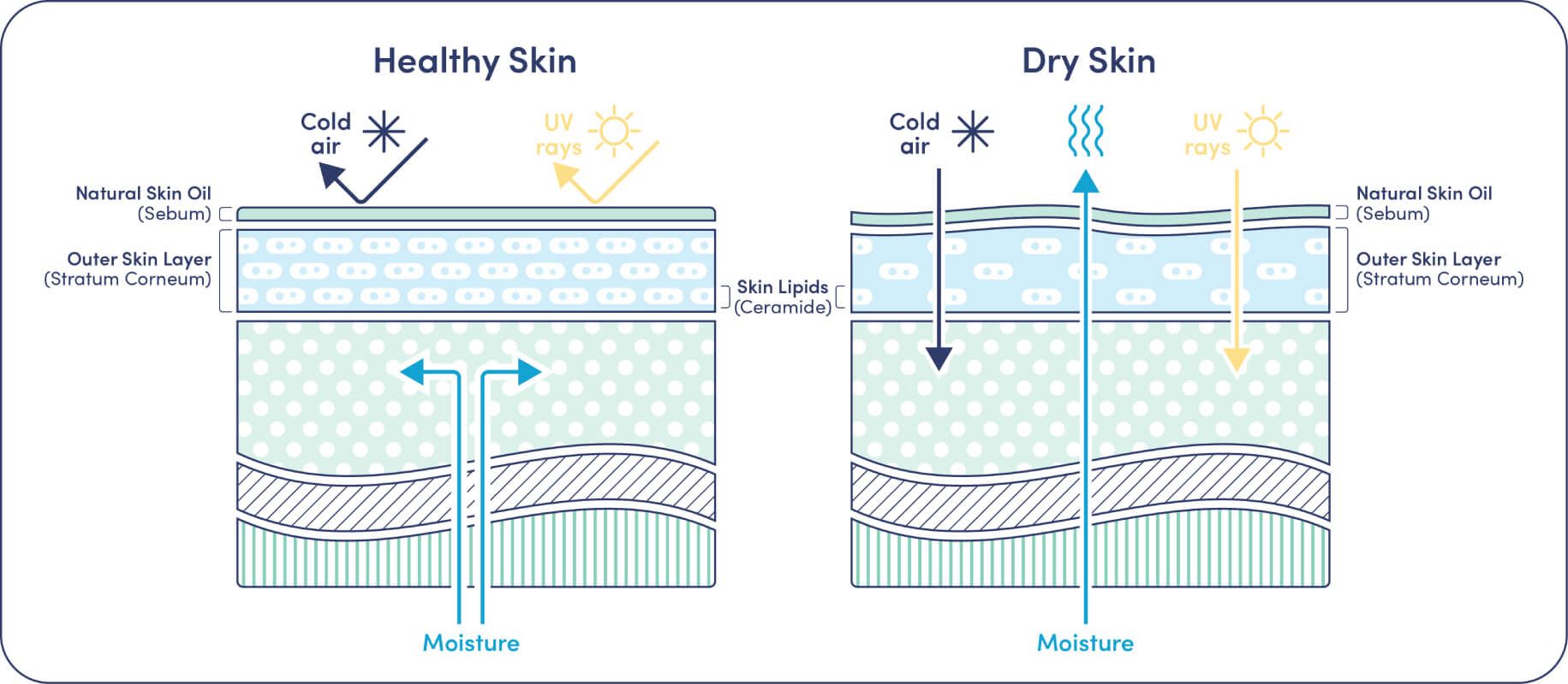 Infographic comparing healthy and dry skin