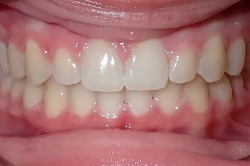 After