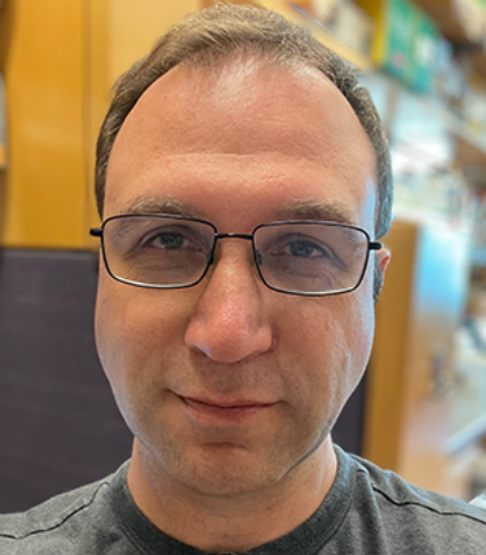 Man wearing glasses looks at the camera