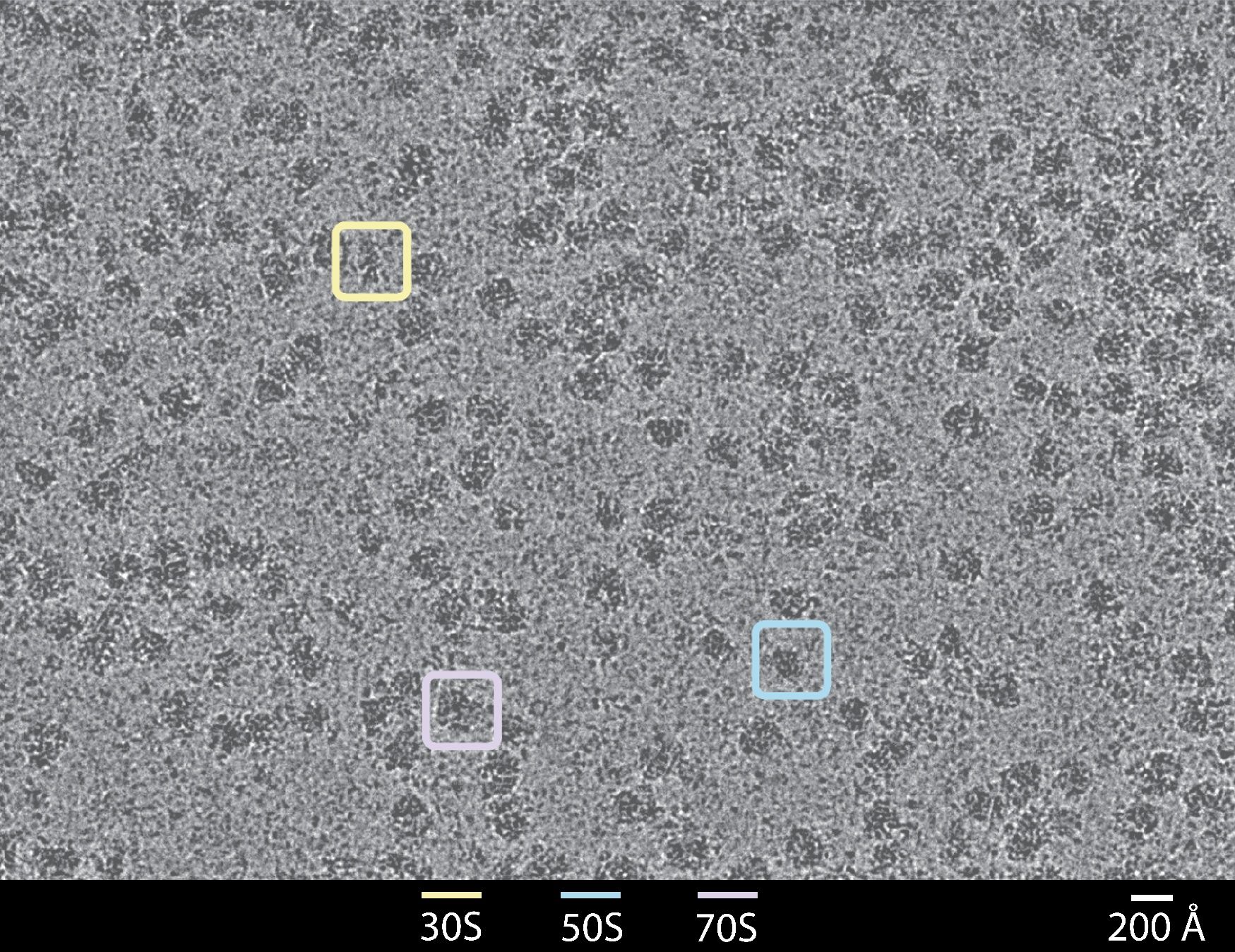 Microscopy image with three highlighted regions and 30S, 50S, 70S labels