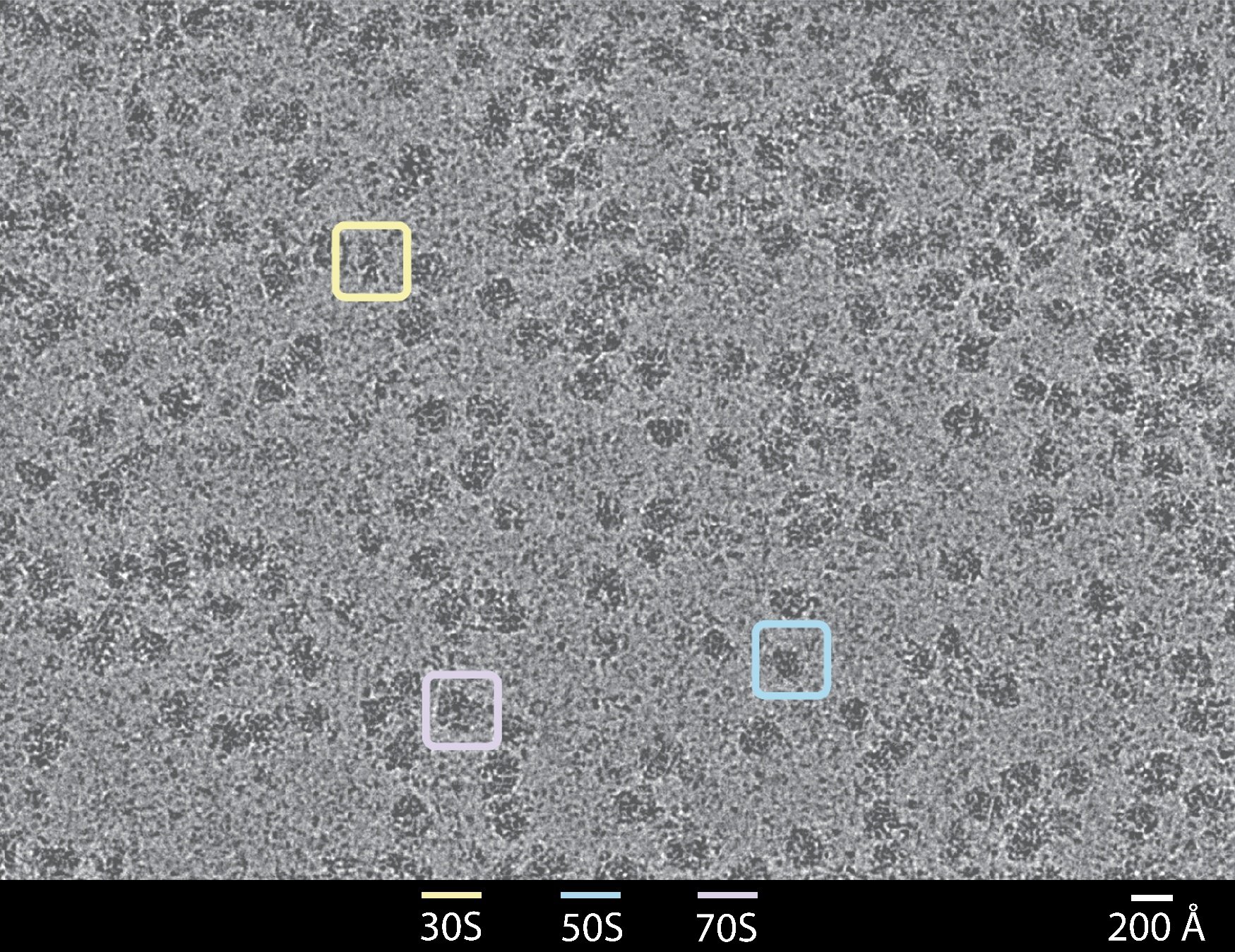 Microscopy image with three highlighted regions and 30S, 50S, 70S labels