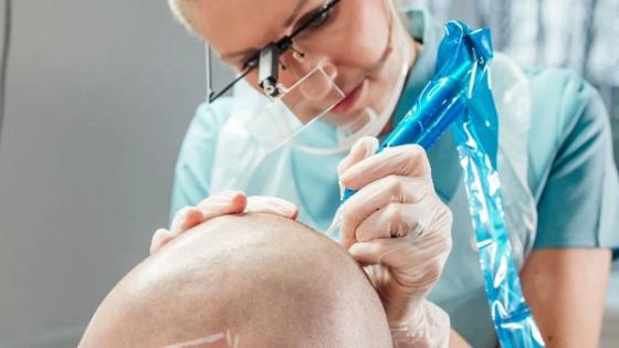 Do’s And Don’ts Of Micropigmentation Marketing