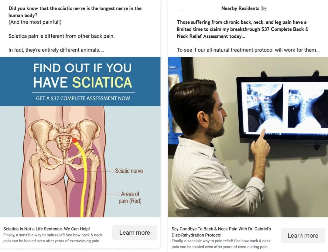 Successful Chiropractic Facebook Ad: Sciatica