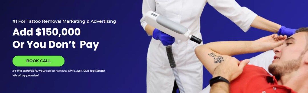 tattoo removal marketing tattoo removal marketing