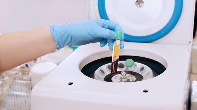 Mastering PRP Marketing: Strategies for Successful Therapy Promotion
