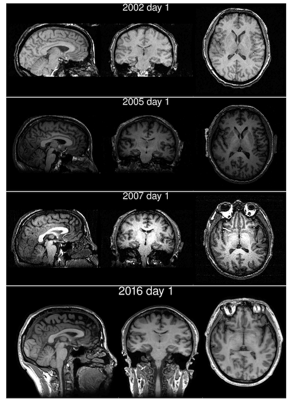 How Does Mindfulness Change The Brain? - Reflect Blog