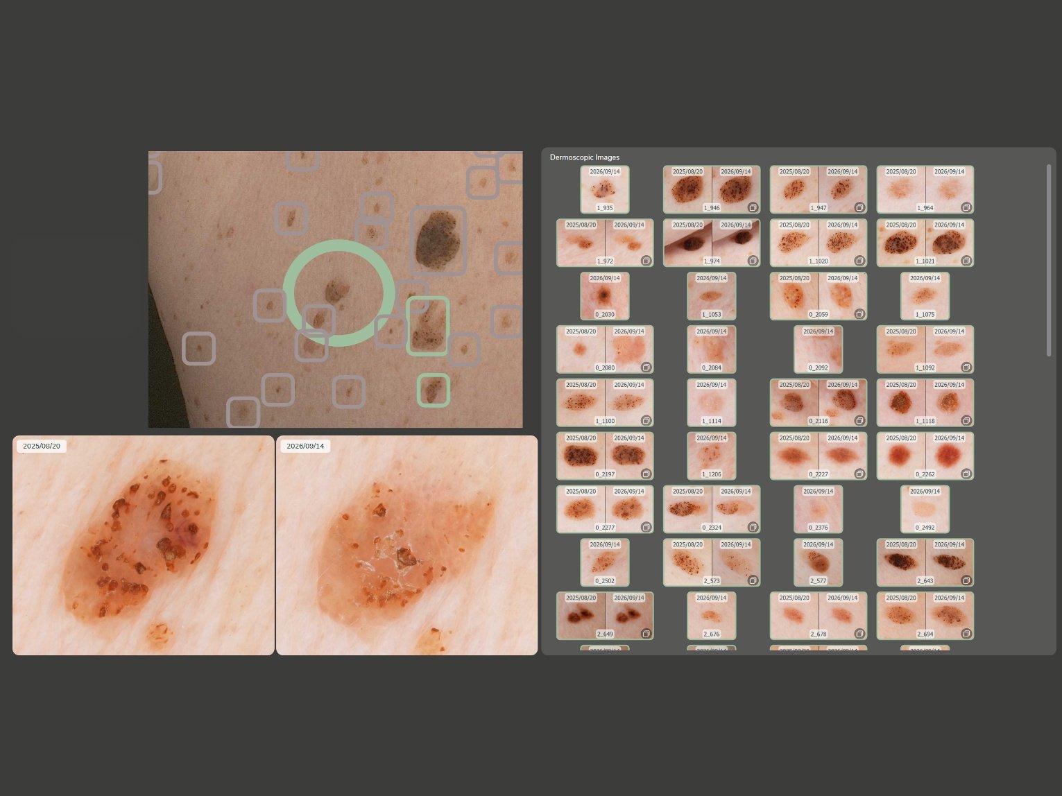 Cartographie Cutanée Corps Entier