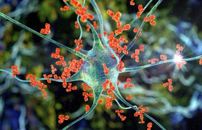 Was sind Autoimmunerkrankungen?