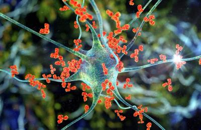 Was sind Autoimmunerkrankungen?