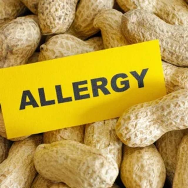 Peanut Allergies 