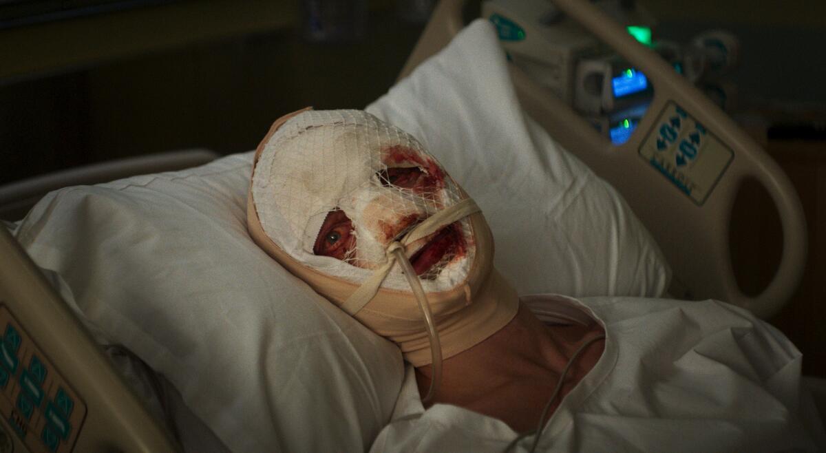 Clayface in hospital bed