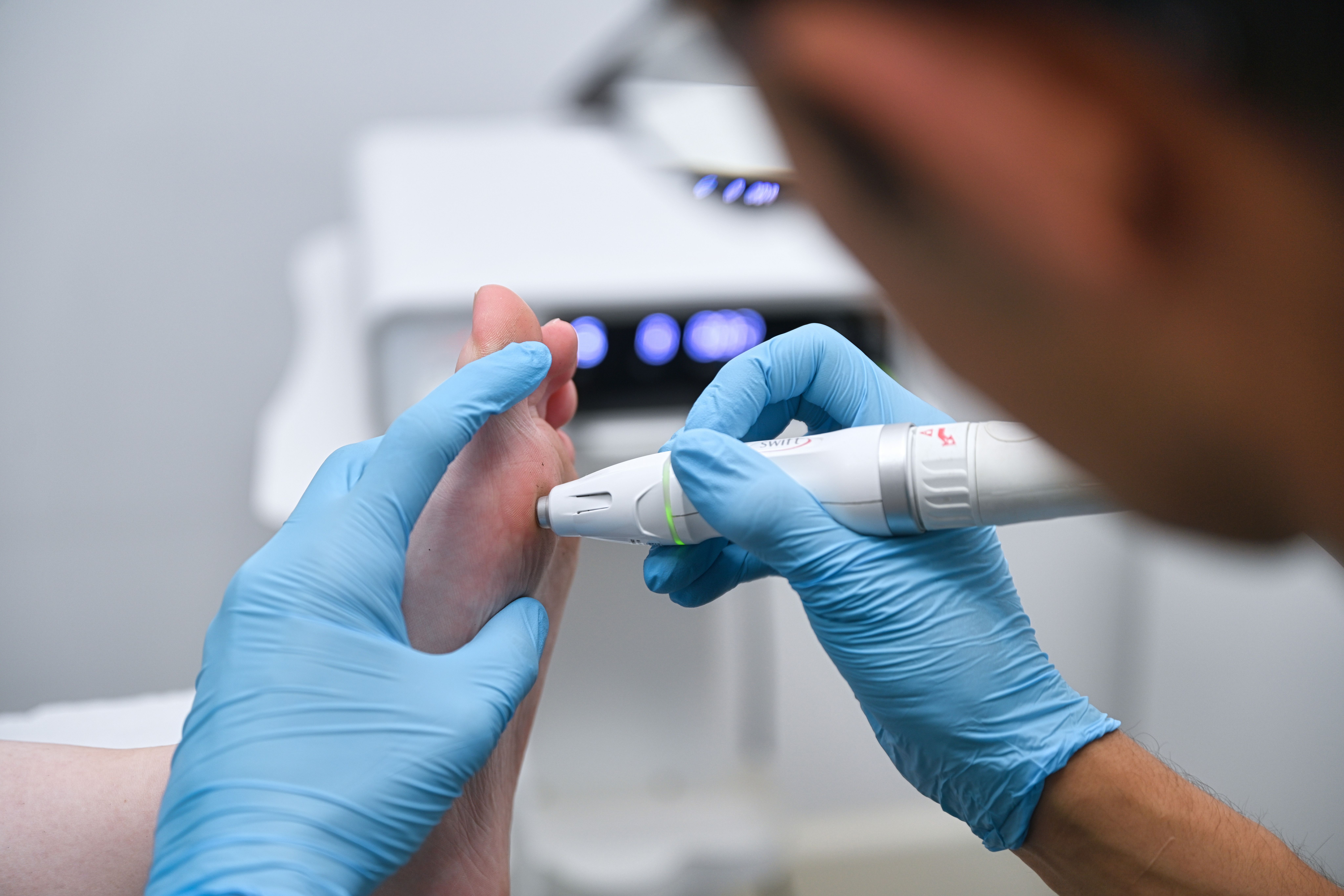 Chiltern Wellbeing podiatrist assessing a patient with SWIFT Microwave therapy