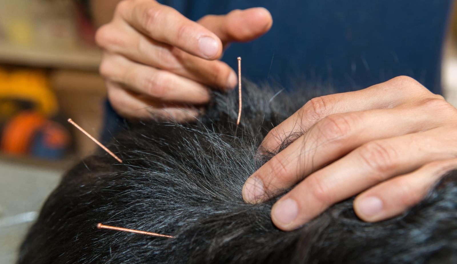 Poke the Pain Away: Dive into the Ancient Wisdom of Acupuncture for Pet Wellness
