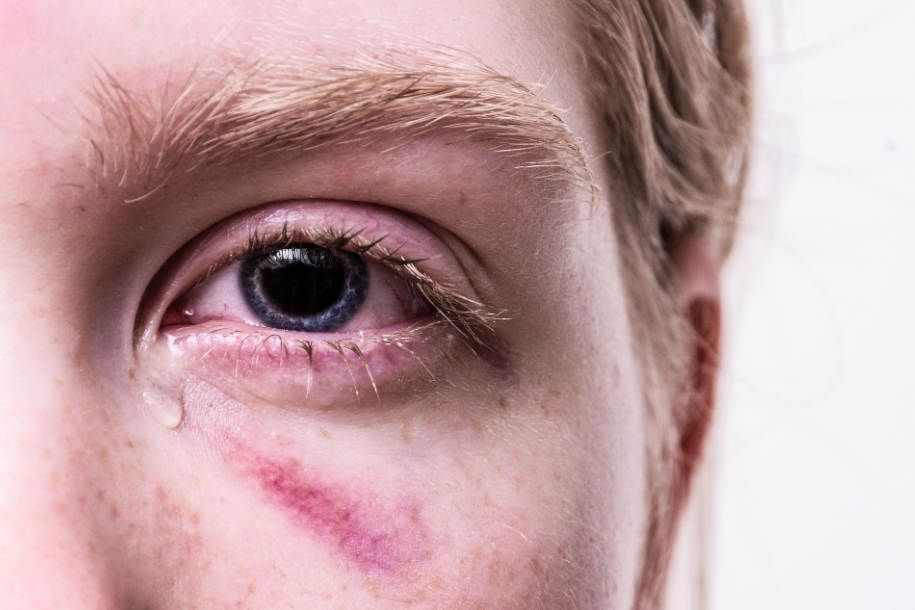 Why Trauma-Informed Mental Healthcare Matters in the UK: What It Can (and Can’t) Do