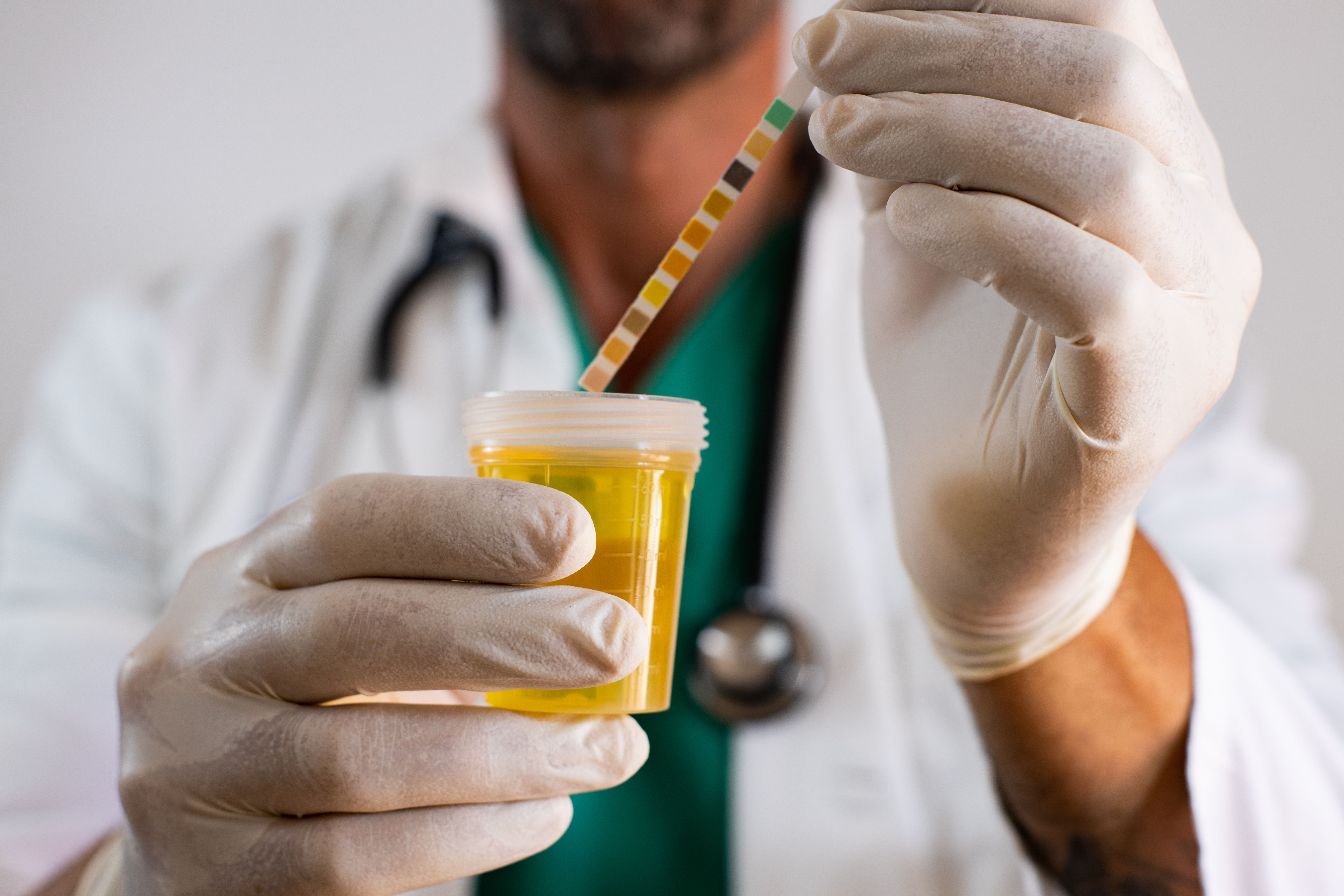 adulterating urine specimens