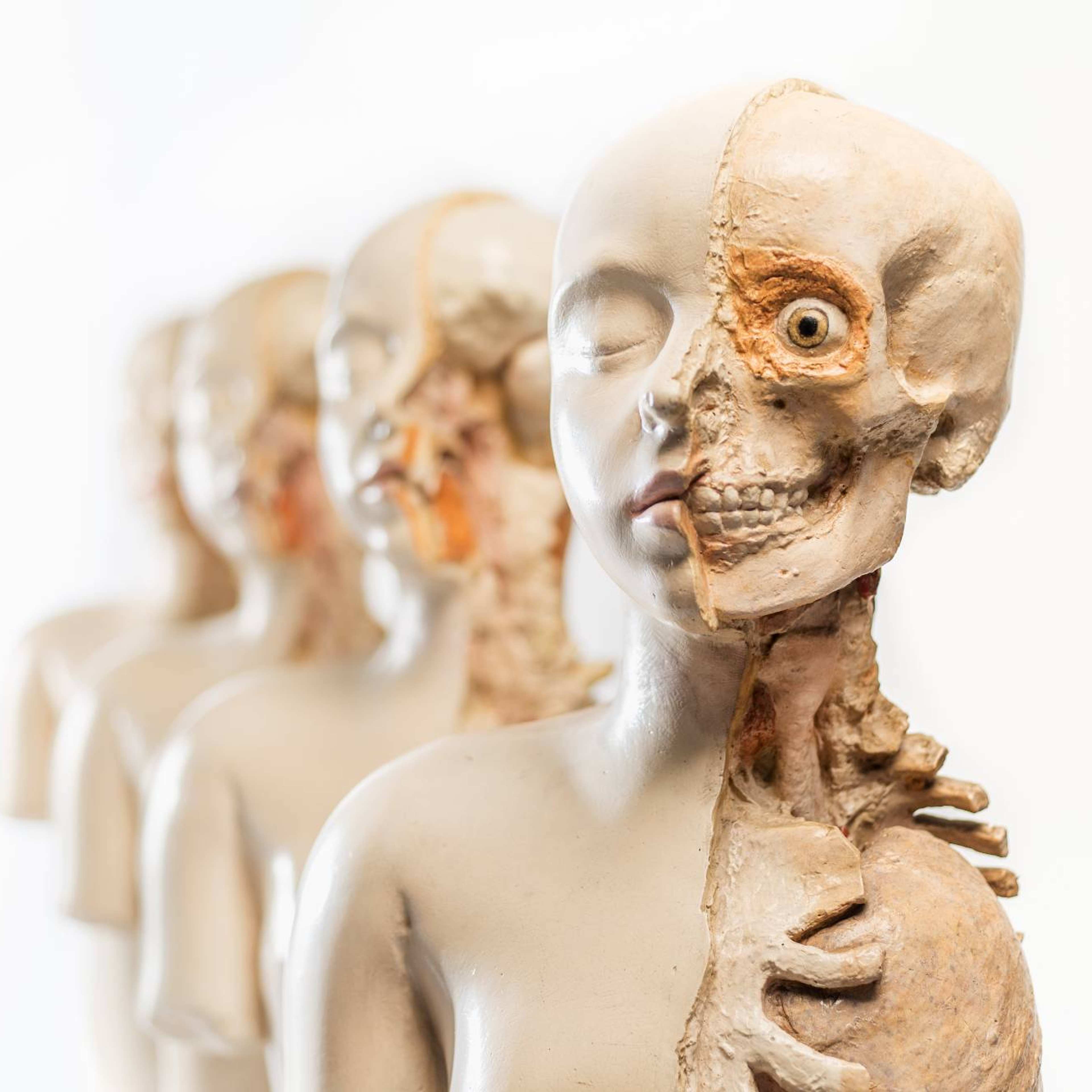 Four anatomical plaster models showing thoracic and abdominal dissections